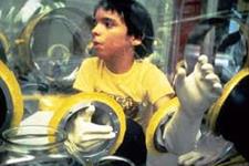 درمان کودکان مبتلا به بیماری "کودک حبابی"
