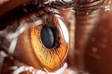 درمان خلاقانه چشم آسیب دیده با سلول های بنیادی و احیای بینایی 