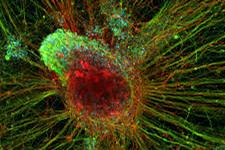 خاموش کردن ژن های ایجاد کننده سرطان با استفاده از سلول های بنیادی مهندسی شده