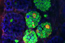 تبدیل سلول های بنیادی به سلول های تولید کننده انسولین