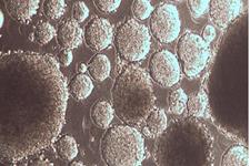 پیوند هپاتوسیت های مشتق از سلول های بنیادی پرتوان القایی انسانی در موش هایی که از نظر ایمنی سالم هستند