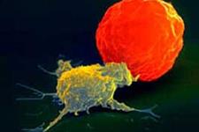 یافته های جدید در مورد لوکمیای تهاجمی سلول های کشنده ذاتی(NK cells)، راه را برای ایجاد درمان های جدید هموار می کند