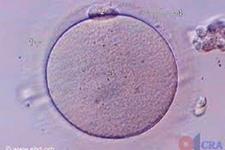 سلول های بنیادی با پتانسیل تبدیل شدن به تخمک های موجود در تخمدان