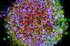 طیف وسیعی از کاربردها برای سلول های بنیادی پرتوان