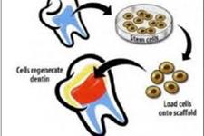 سلول های بنیادی دندان می توانند درمانی برای بیماران با مشکلات دندانی باشند