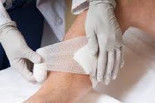 یک زخم پوشش(پانسمان) مبتنی بر میدان الکتریکی برای کمک به بهبود عفونت های زخم