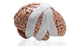 چسب مغزی آسیب های مغزی ترومایی را ترمیم می کند