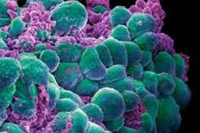 سیستم کشت سلول می تواند در زمینه سرطان موفقیت به ارمغان بیاورد