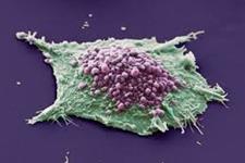 فرایندی دو مرحله ای که منجر به نامیرایی سلولی و سرطان می شود