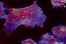 سلول های بنیادی می توانند آسیب بافتی ناشی از پرتو درمانی را مهار کنند