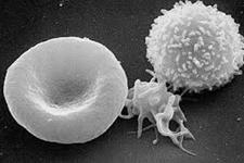 یکی از پروتئین های مورد نیاز برای سلول های بنیادی می تواند در کشتن سلول های سرطان سینه هدف قرار گیرد