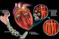 سلول های بنیادی پیوند شده از مغز استخوان به قلب می توانند عملکرد قلبی را بهبود ببخشند