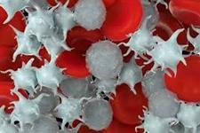 ایجاد مدل جدیدی که تبدیل شدن سلول های خونی طبیعی به سلول های لوکمیایی را نشان می دهد