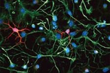 پاکسازی تجمعات پروتئینی در سلول های بنیادی عصبی پیر، فعالیت آن ها را افزایش می دهد