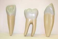 دندان های زیست مهندسی شده برای جایگزین کردن دندان های از دست رفته