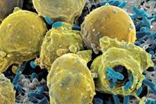 آیا سلول های بنیادی ارتباط بین باکتری ها و سرطان هستند؟