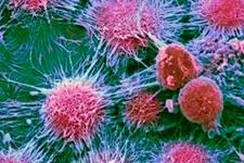 شناسایی مولکولی که سلول های توموری سرطانی را بدون آسیب رساندن به سلول های سالم تخریب می کند