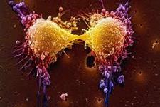امیدوار کننده بودن نانوذره های فلورسنس چند عملکردی برای جراحی سرطان