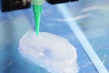 می توان سلول های غضروفی زیست پرینت شده سه بعدی را ایمپلنت کرد