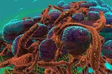 مبارزه با سرطان به کمک سرطان: کشت های سلولی سه بعدی به ایجاد درمان های دقیق کمک می کنند