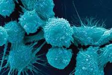 کشف یک راه بالقوه جدید برای کشتن سلول های سرطانی