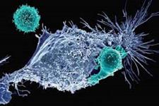 ایمنی درمانی CAR-T cell بازیگر جدیدی را رو کرده است