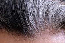 ارتباط بین موی خاکستری با فعالیت سیستم ایمنی و عفونت ویروسی