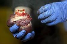 اولین پرینت سه بعدی قلب با بافت و عروق انسانی