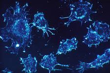 سلول های Th17 می توانند کاربرد بالینی وسیع تر از ایمنی درمانی سازشی را تسهیل کند