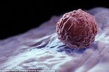 پیوند سلول های بنیادی جنینی و ایجاد تومور خوش خیم در پسر 17 ساله