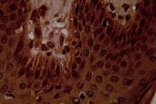 پتانسیل سلول های بنیادی فولیکول مو در ترمیم نورون های آسیب دیده
