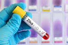تشخیص موفقیت آمیز ویروس زیکا در مایع سمن