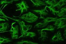 چگونه سلول های گلیالی مغز از سلول های پیش ساز عصبی تکوین می یابند
