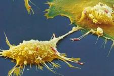 به لطف استفاده از دارویی جدید، سلول درمانی بیماران سرطانی به میزان قابل توجهی افزایش یافته است