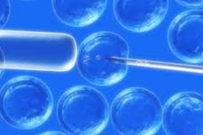 سلول درمانی برای موتاسیون کشنده ژن STAT1 نتایج مختلفی را تولید می کند
