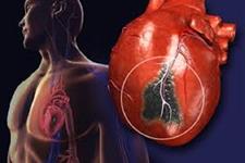 گرافت های آزمایشگاهی جریان خون را در قلب های انفارکته شده رتی افزایش می دهد