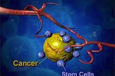 عود مجدد سرطان به سلول های بنیادی بستگی دارد