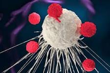39 درصد بیماران مبتلا به لنفومای سلول های B که مورد CAR T سل درمانی قرار گرفته اند در بهبودی کامل به سر می برند