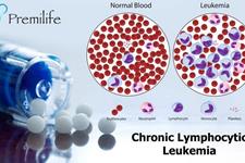 یک نقطه ضعف در درمان لوکمیای لنفوسیتیک مزمن(CLL)