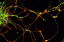 چه چیزی سرنوشت سلول های بنیادی عصبی را تعیین می کند
