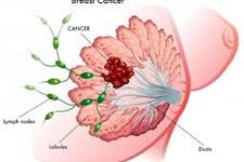 چگونه Frizzled7 می تواند چگونگی تکوین سرطان سینه را آشکار سازد؟