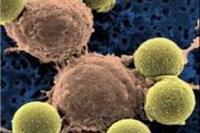 هدف قرار دادن مسیرهای خودنوزایی در سلول های بنیادی سرطانی