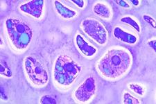 آیا میکروپلت(تجمع سلولی) سلول های بنیادی مزانشیمی در مقایسه با تک سلول ها بازسازی غضروفی بهتری انجام می دهند؟