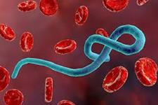 راهی جدید برای مبارزه با ابولا