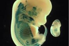 شناسایی اولیه ترین ژن کشنده جنینی