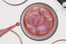 تولید سلول های بنیادی جنینی از پوست