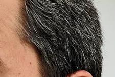 یافته هایی که می توانند به شناسایی درمان های جدید برای طاسی و خاکستری شدن مو کمک کنند