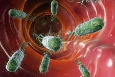 باکتری های سیستم گوارشی خطر عفونت های خطرناک بعد از شیمی درمانی را پیش بینی می کنند