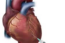 مطالعه ای جدید نشان می دهد که سلول درمانی ترکیبی موجب بهبود عملکرد قلبی بعد از حمله قلبی می شود