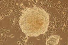 کشت سلول های بنیادی پرتوان القایی بدون استفاده از سلول های فیدر